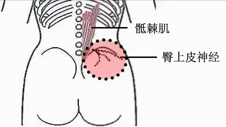 彻底治好腰椎间盘突出的方法,各种腰椎间盘突出治疗方法的弊端
