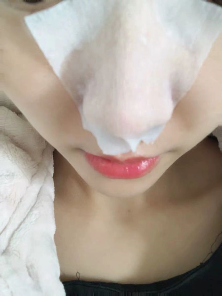 美容院清洁黑头会让毛孔变大吗,黑头拔了毛孔变大会自己愈合吗