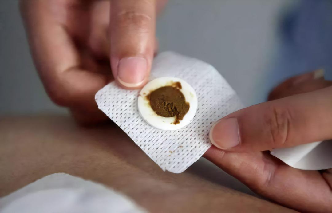 2023入伏三伏贴,三伏贴末伏最后一贴