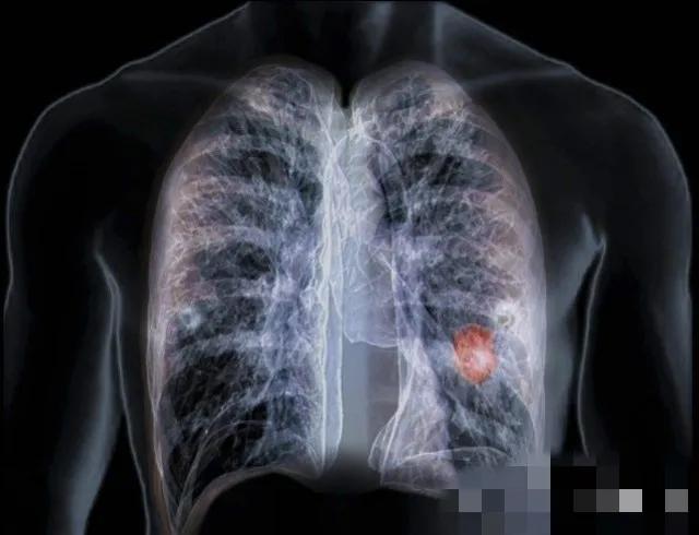 电焊是不是很受罪,电焊工有哪些危害