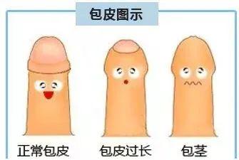 脱掉这层“皮”夏季更清爽！