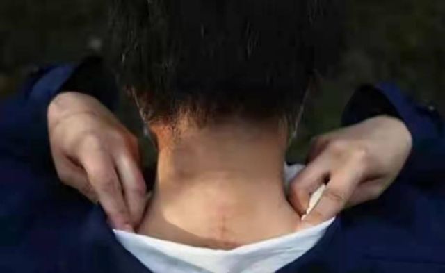 八达岭老虎咬人女子受伤情况,八达岭老虎伤人事件女毁容