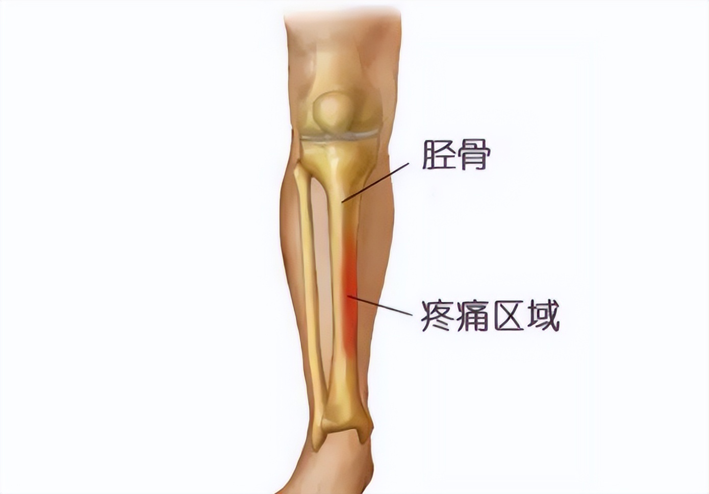 世界杯最痛苦球员,世界杯受伤的人