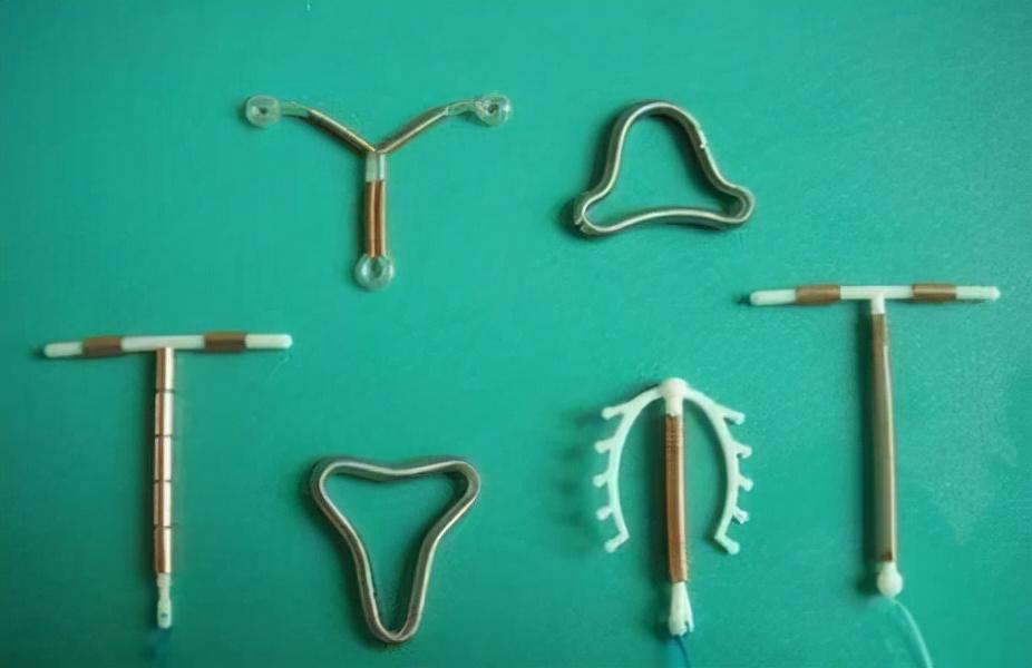 我国第一批上环的女性现在怎么样,第一批上环的女性现状