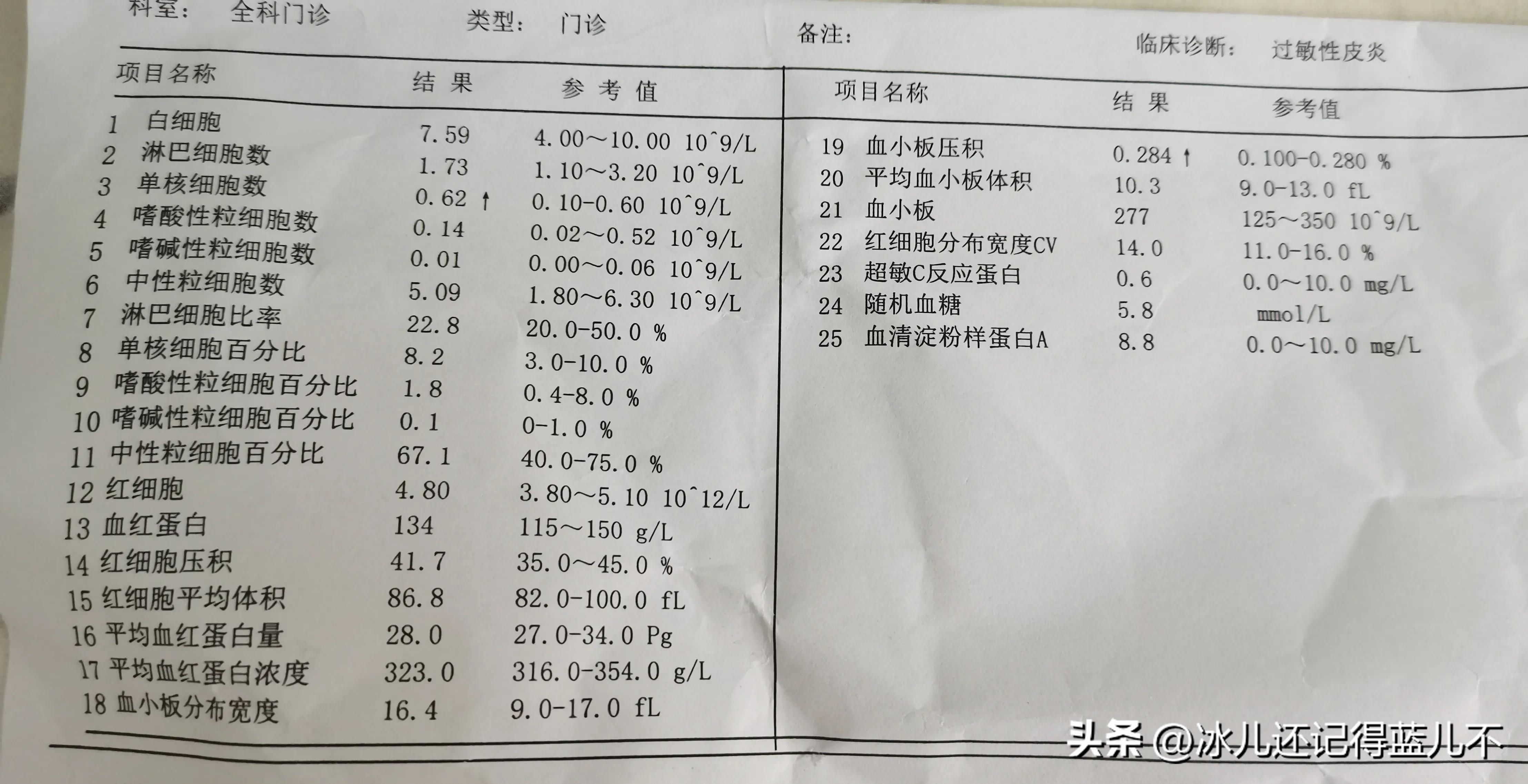 过敏性皮炎眼皮痒，去社区医院花了265元，我头条一个月收益才够