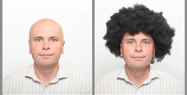 脱发中药内调药方,治疗鬼剃头的中药能治脱发吗