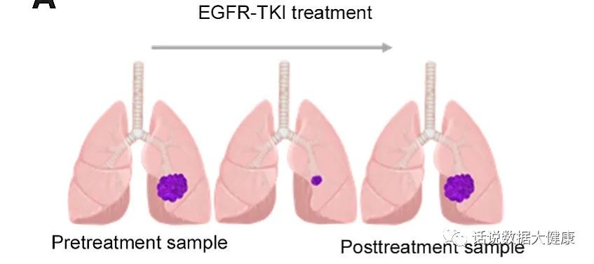 靶向药怎么防止癌症耐药,治疗癌症的靶向药会产生耐药性吗