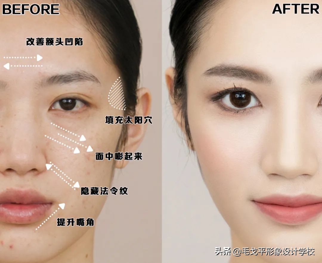 凹陷疤痕修容,菱形方脸脸颊凹陷怎么修容