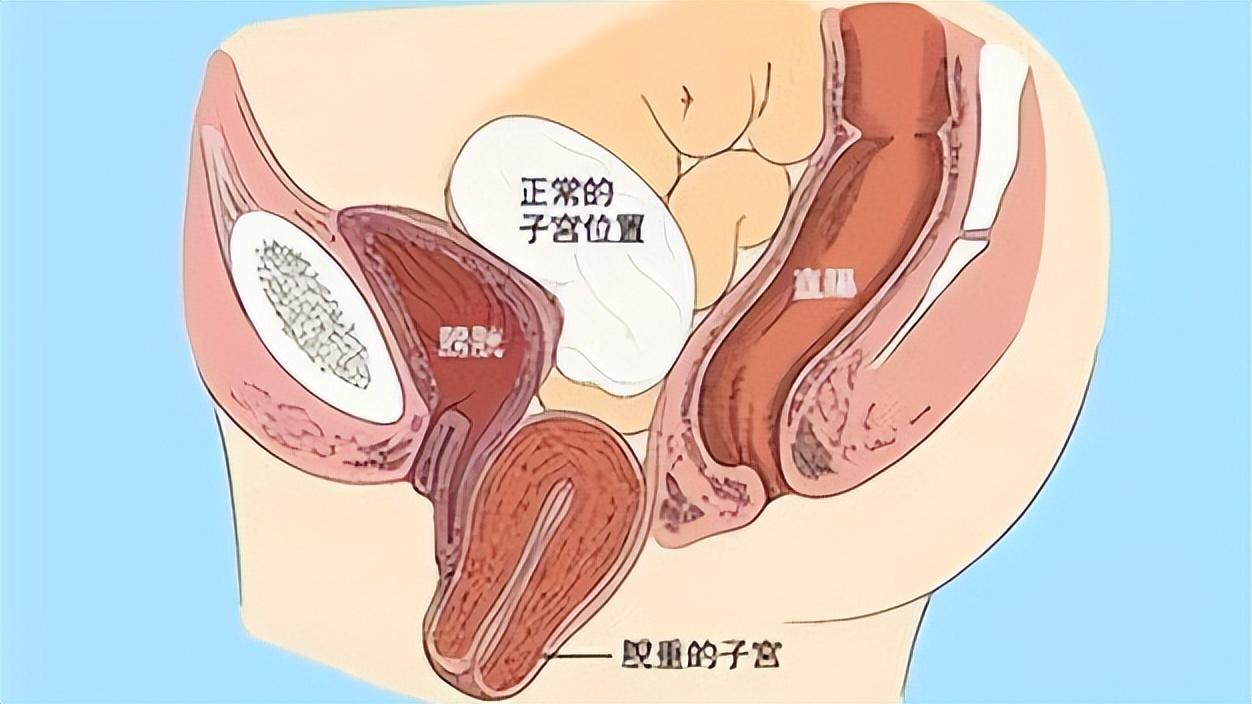 健康女性摘除子宫有影响吗,关爱女性健康不要堕胎