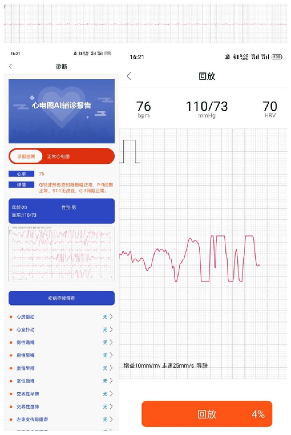 可测血糖曲线的智能手表？didoE10SPro智能手表体验分享