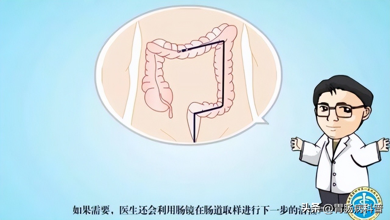 做肠镜检查前怎样清肠最彻底,肠镜检查前清肠的药怎么喝