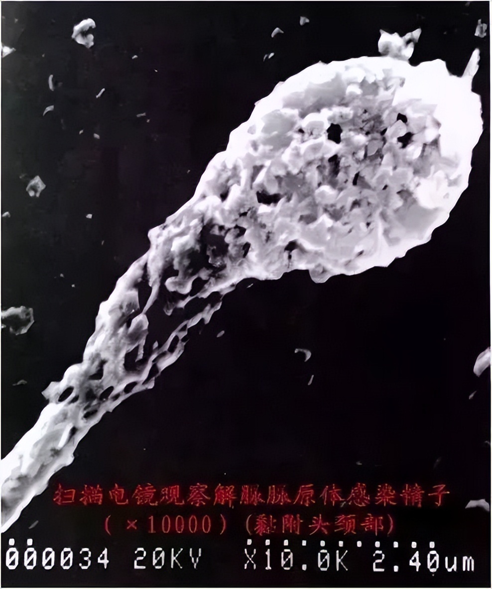 看不育不孕要禁食吗,看不孕不育要看专家吗