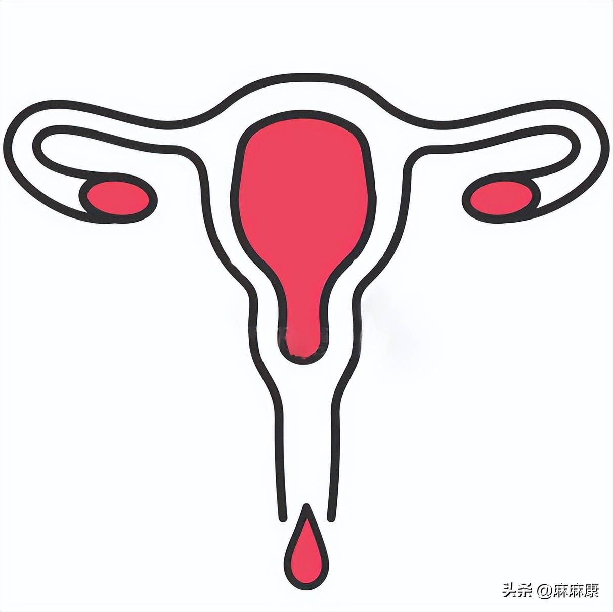 同房出血怎么办?这些措施很重要