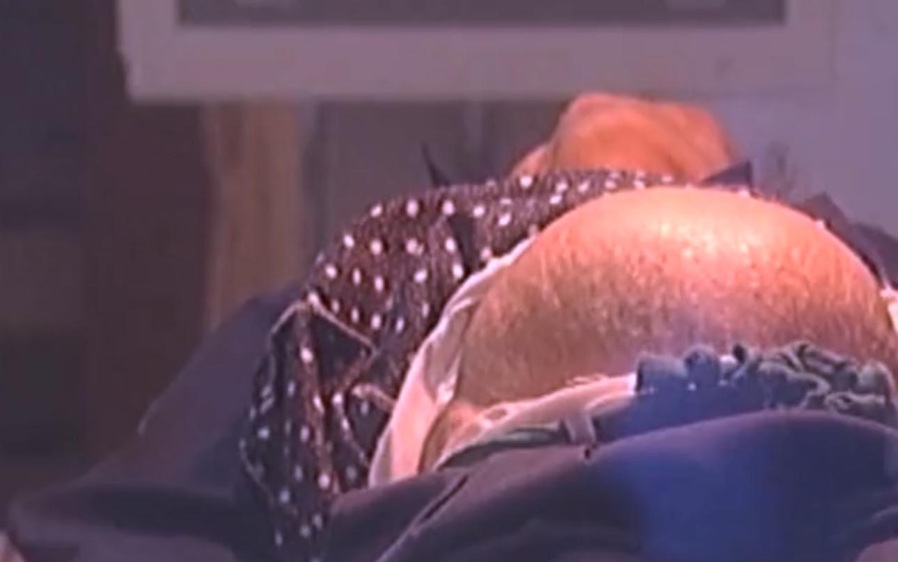 2007年四川90岁老妇，腹中怀子60年未生，后检查发现胎儿没有腐烂