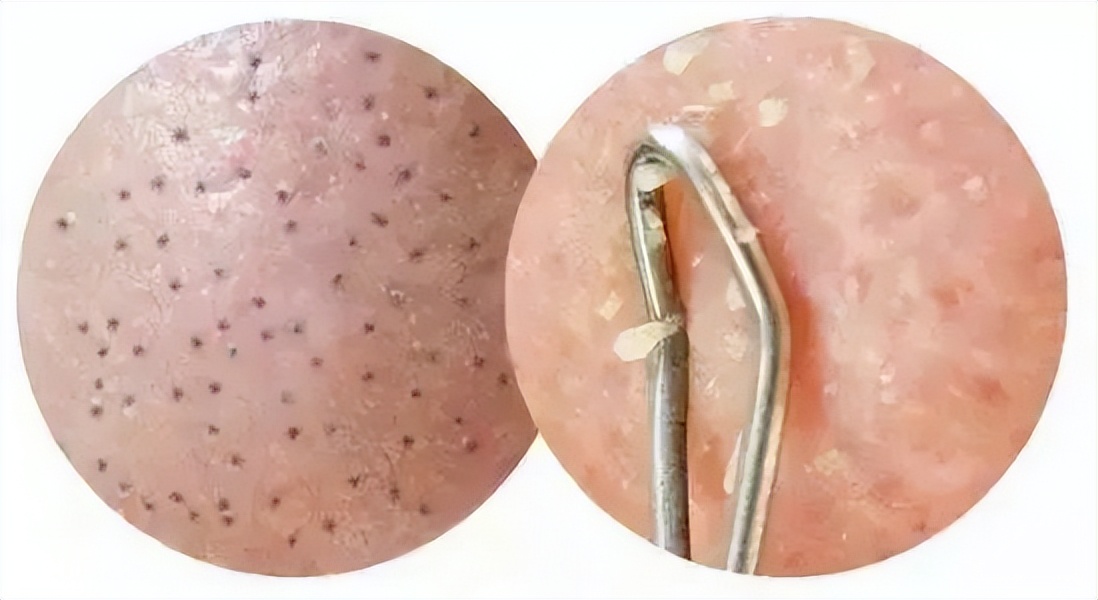 科颜氏白泥面膜清洁去黑头125ml,科颜氏白泥面膜真的能去黑头吗