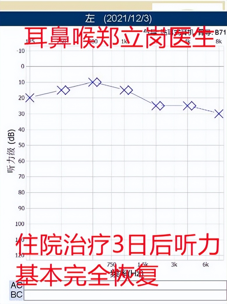 一侧耳朵闷堵听力下降可以自愈吗,突然耳朵堵住的感觉怎么解决
