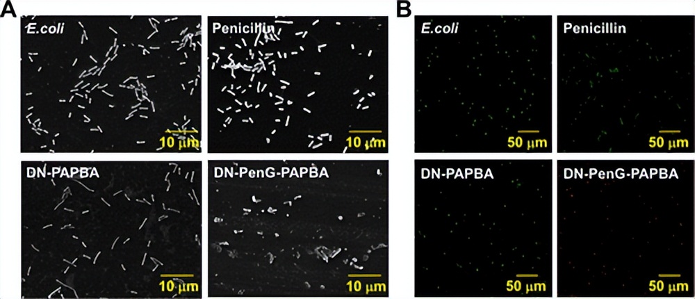 双重聚合的坚韧抗菌金属聚合物双网络水凝胶