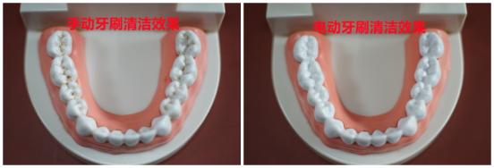 小米牙刷t100和t300和t500区别,电动牙刷与普通牙刷相比有什么区别