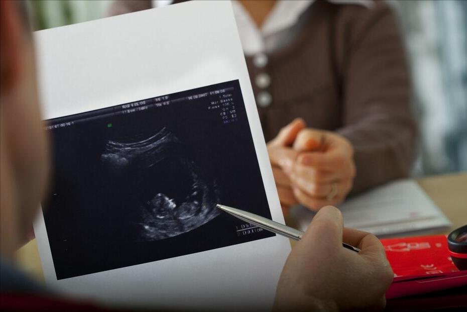 25岁已婚女性月经紊乱,导致20岁女孩月经紊乱的原因