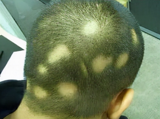 一夜间全村遭鬼剃头,山村鬼剃头真相