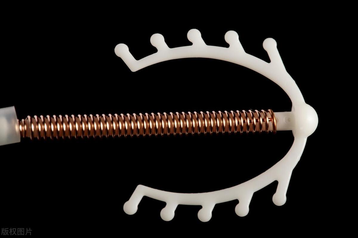 女人上环什么时期是最好的,女性上环的种类和形状