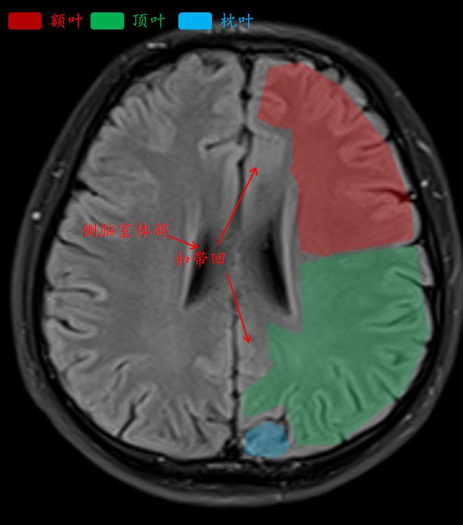 肘关节mri图谱大全,腕关节mri解剖图谱