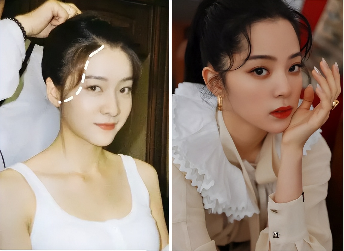 扁平脸影响美感,扁平头会对颜值有影响吗