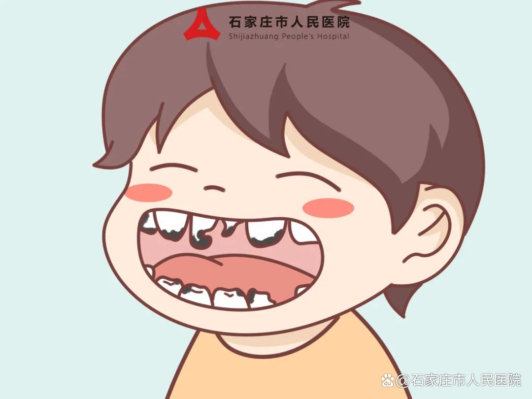 乳牙龋坏的全过程,乳牙龋坏需要根管治疗吗