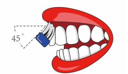 小米声波电动牙刷伤牙齿吗,什么电动牙刷好用又不伤牙齿