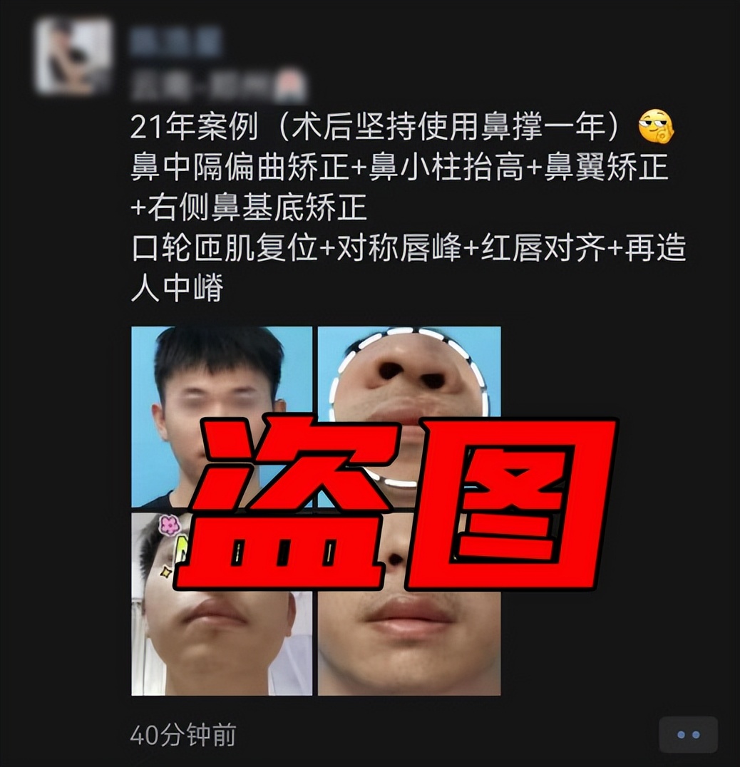 唇裂手术红唇裂开会自动愈合不,唇裂手术后伤口一直红怎么办