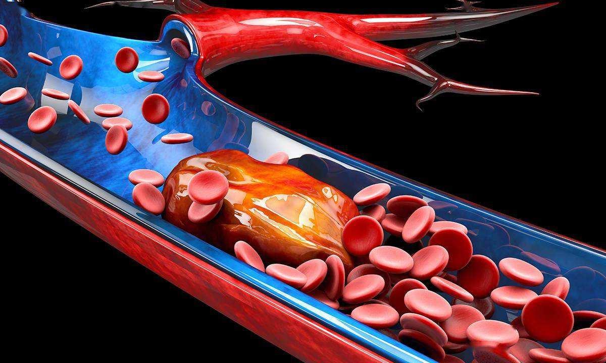 无偿献血后用血为什么这么难,献血科普关于无偿献血7大真相