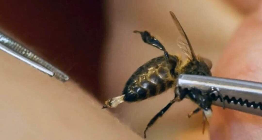 蜜蜂为什么蜇人后会死,蜜蜂为什么蜇人会死