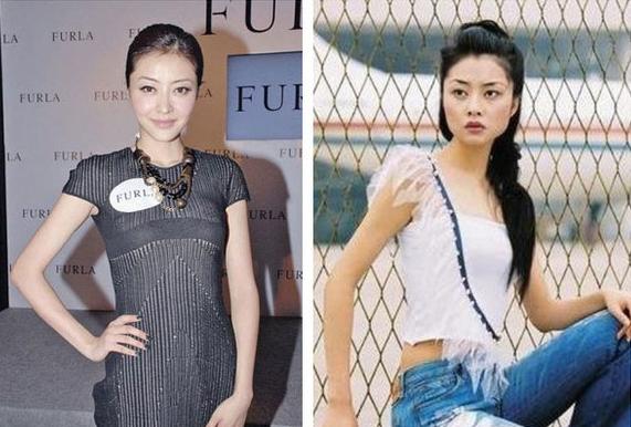 盘点整容失败惨不忍睹的30位女星,那些整容整失败的女明星