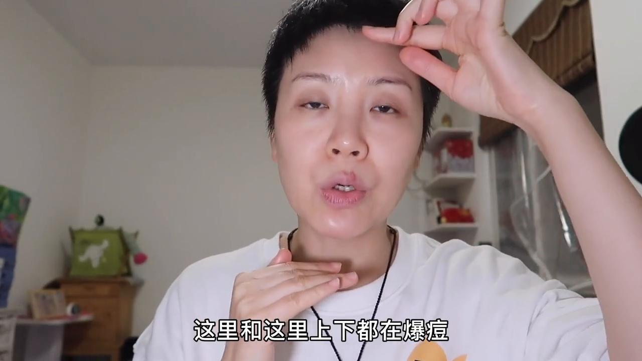 月见草吃了长痘痘什么原因,吃月见草为什么皮肤会好