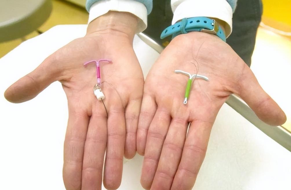 节育环更年期后是否要取出,节育环一直不取绝经后出血