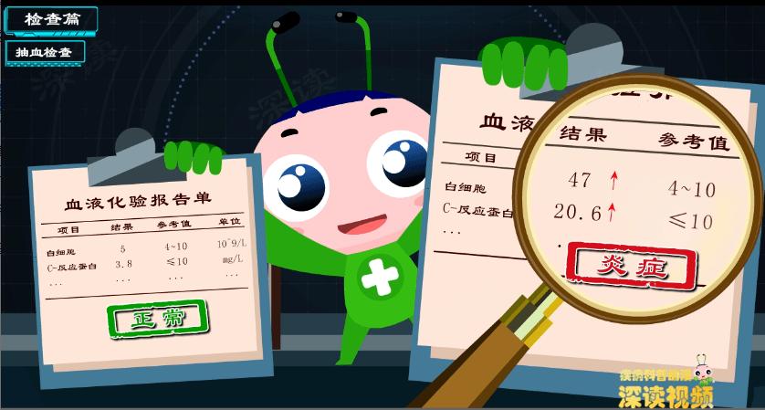 胆囊炎胆结石怎么保守治疗,胆结石胆囊炎胆绞痛发作