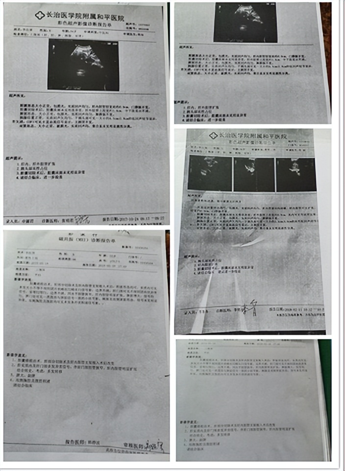 陈海林治疗癌症,陈海林肿瘤名医