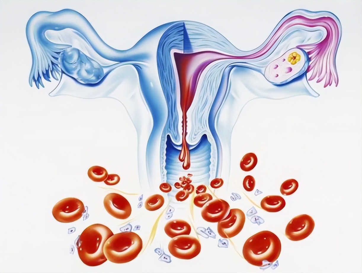 为什么会月经过后有褐色分泌物,为什么月经结束后出现褐色分泌物