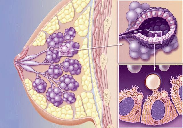 乳头出现溢液你需要进行这些检查、治疗和预防(下)