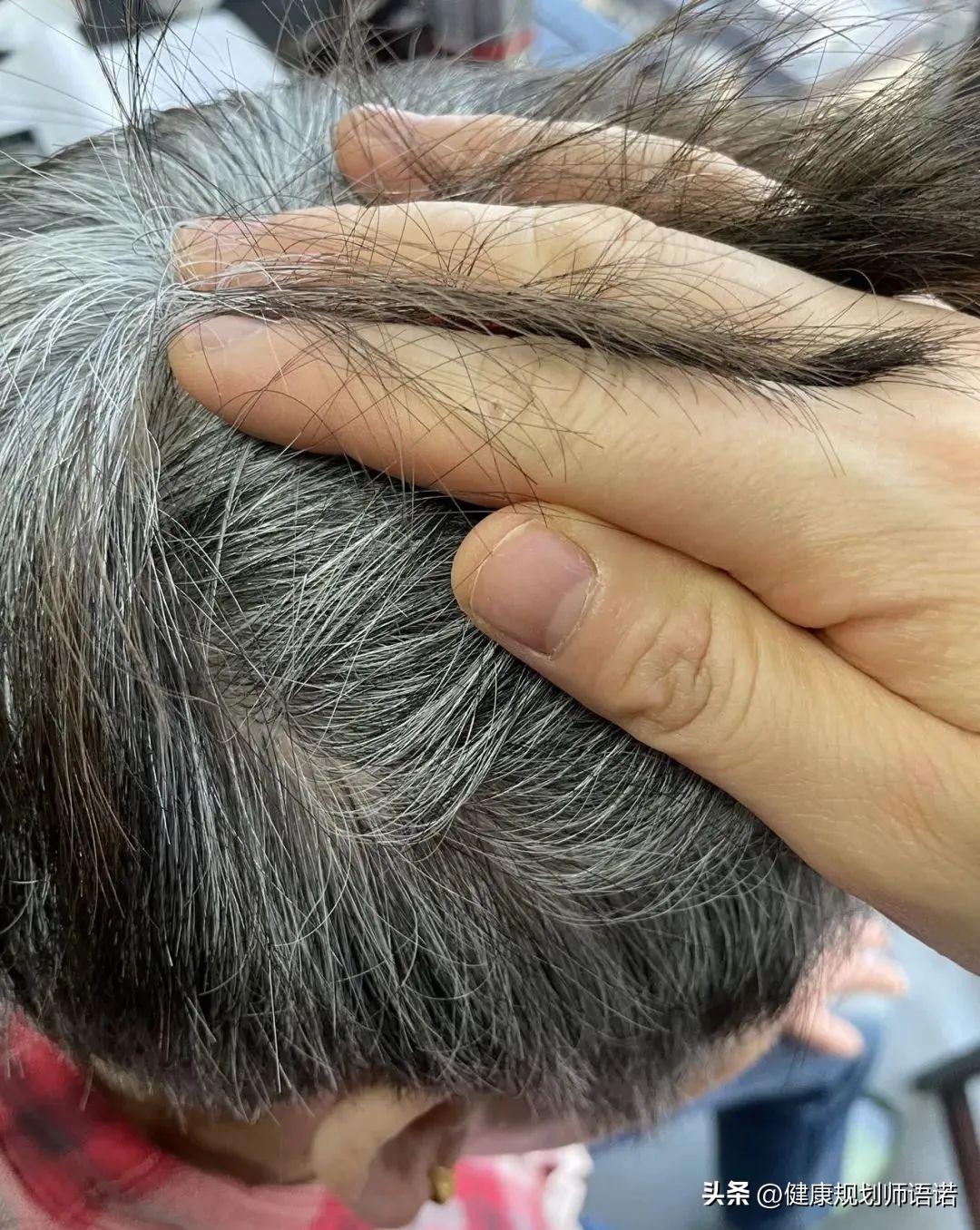 因宫颈问题走进阳光森林，用营养拯救了整个家族的健康