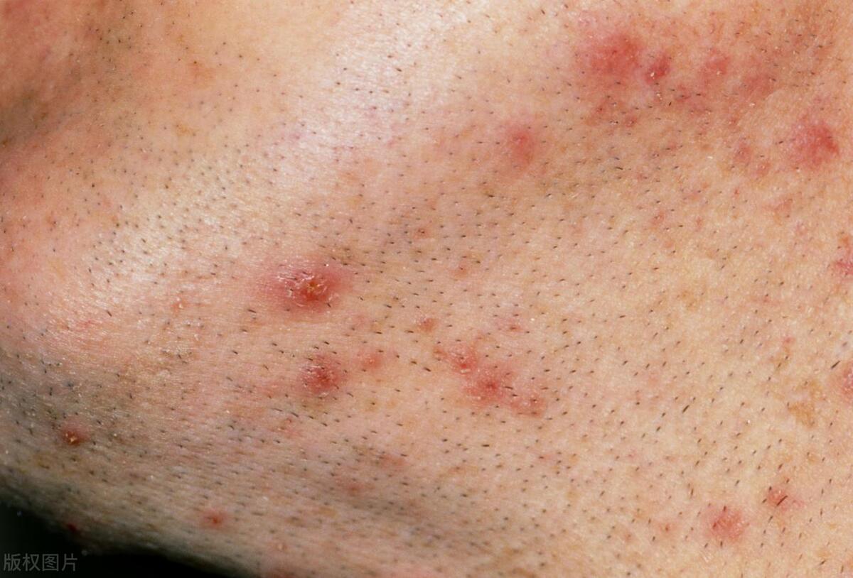 为什么有人“下面”没有毛？别害羞，了解私密处毛发的5种用处