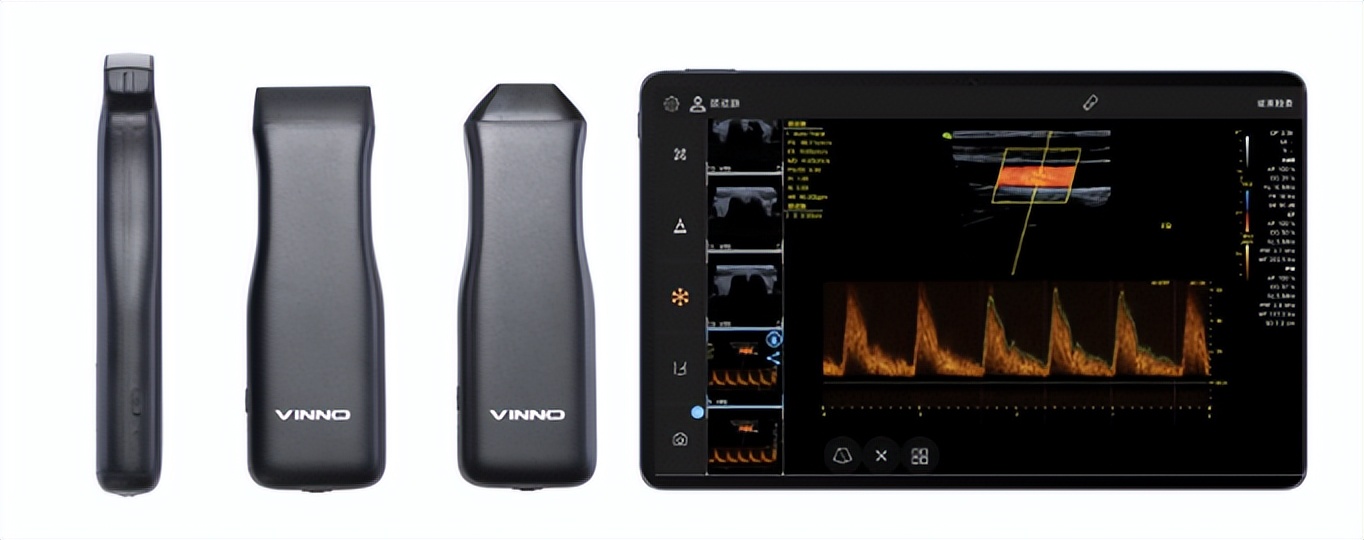 破多项纪录,首个可穿戴超声来了