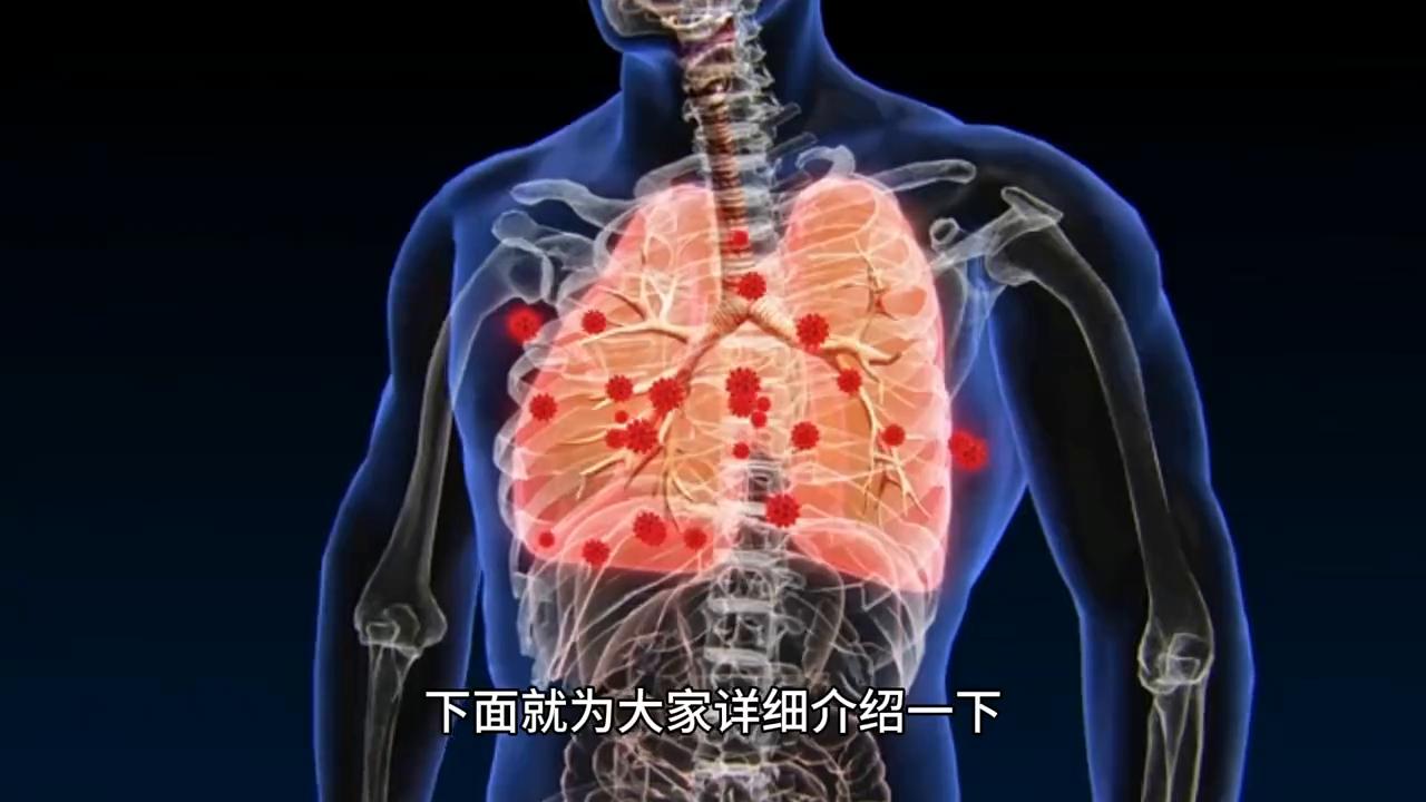 肺气肿怎么预防肺功能下降,肺气肿冬天吃什么食物最好