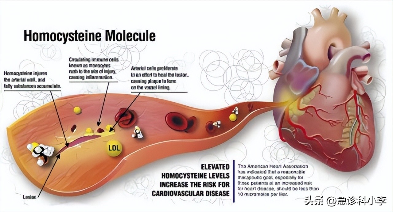 甲钴胺可以修复脑部神经受损吗,大脑中枢神经受损吃甲钴胺可以吗