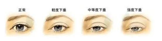 眼部护理的小秘密,眼部护肤应该涂哪些护肤品