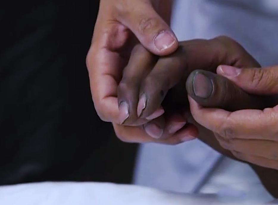 喝一口百草枯还有救吗,喝了一口百草枯还有救吗