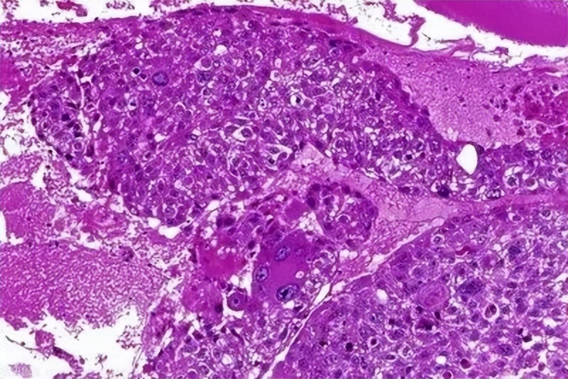 王熙凤为什么会得下红之症,红楼梦中的王熙凤得的是什么病