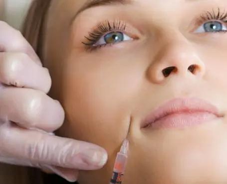 法令纹相当于什么,法令纹是填充还是除皱