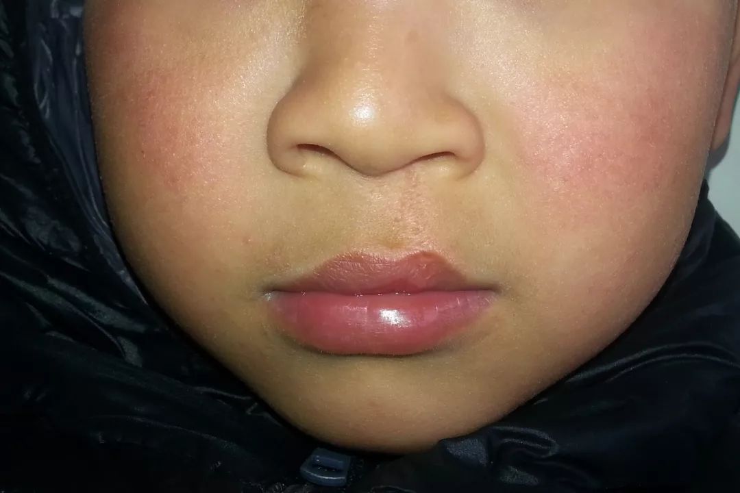 孩子爱吃手咬人咬指甲怎么办,孩子总咬手指甲和东西