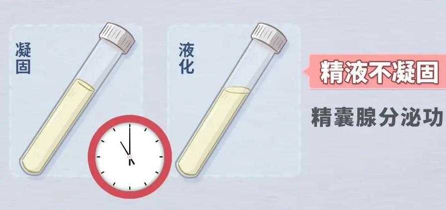 怎么看出男性精子质量不行,如何看出男性精子质量